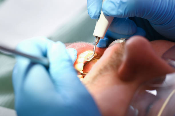 Best Emergency TMJ Treatment in Eureka, MT